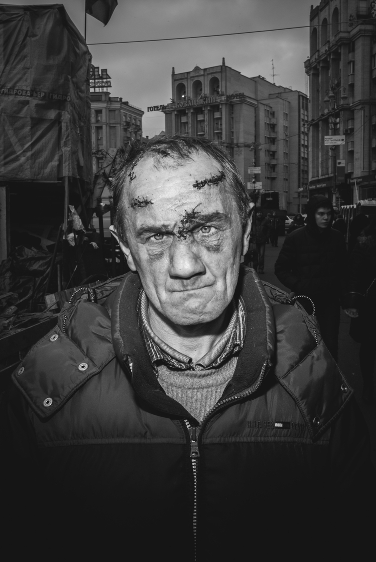 Zdjęcia pojedyncze, II miejsce w kategorii "Portret sesyjny", fot. Maksymilian Rigamonti

Kijów. Po tragicznych wydarzeniach z tzw. czarnego czwartku 20 lutego 2014 roku, gdy siły rządowe i snajperzy strzelali do demonstrantów, zabijając ok. 70 osób, obywatele Ukrainy składali hołd poległym bohaterom. Zdjęcie pochodzi z cyklu portretów ludzi opłakujących ofiary – uczestnik walk na barykadach został opatrzony w szpitalu polowym i wrócił na Majdan Niepodległości, gdzie pomagał nosić trumny z ciałami poległych. 25 lutego 2014 roku.