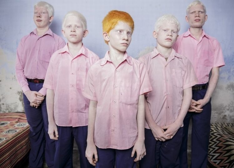 I nagroda w kat. Portret pozowany - zdjęcie pojedyncze, "Blind Indian Albino Boys", fot. Brent Stirton
